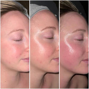 Why Increasing Cell Turnover is Essential for Glowing Skin