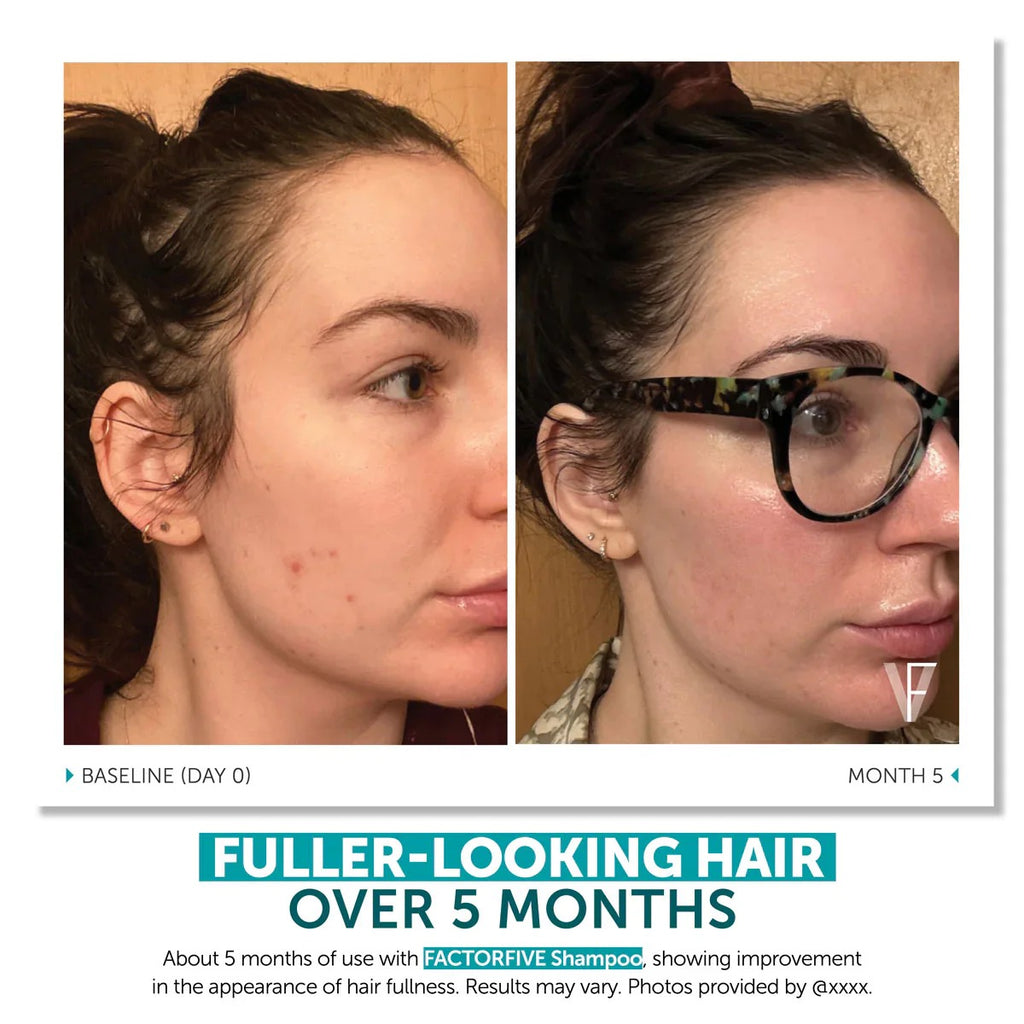 FactorFive Advanced Haircare Shampoo